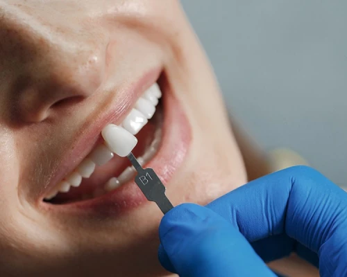 القشرة التجميلية